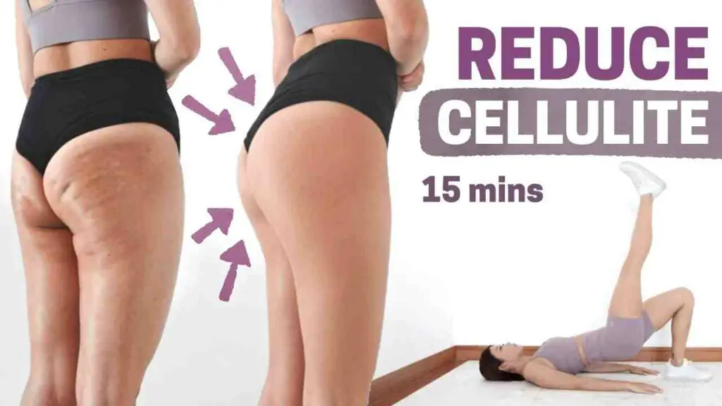 Does Cellulite Go Away When You Get Toned?